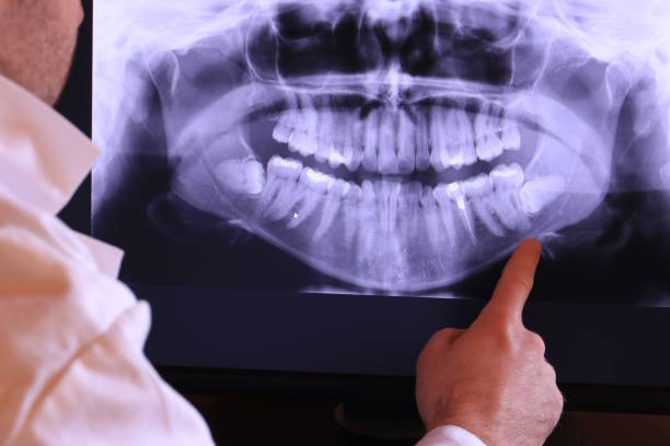 Best Emergency Root Canal Treatment in Sherman, IL